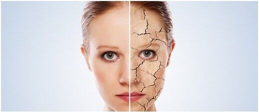 Mes gydome psoriazę